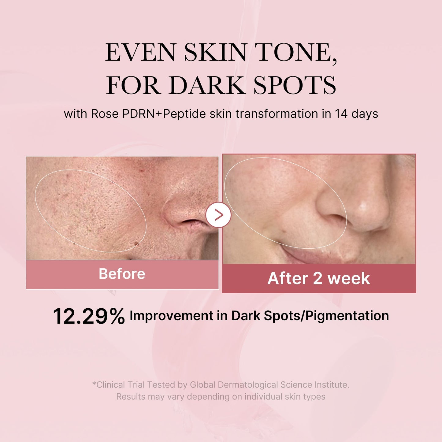 PDRN Pink Toner