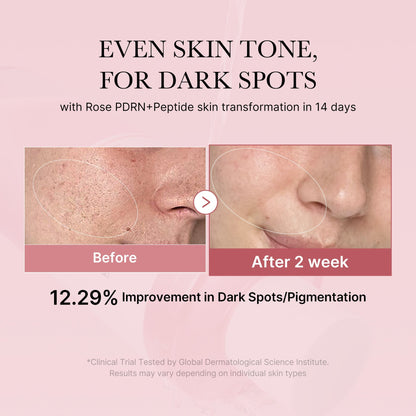 PDRN Pink Toner
