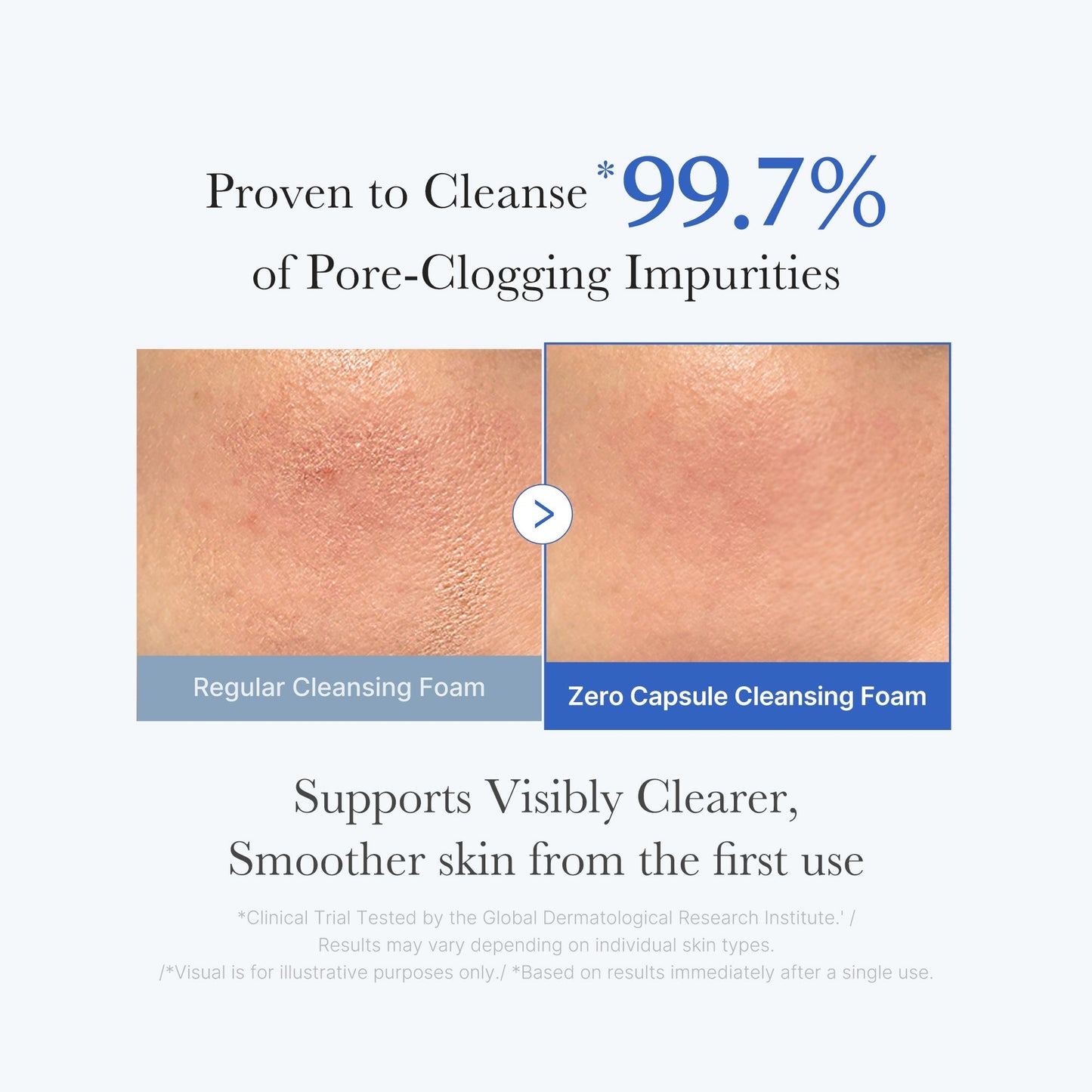 Zero Pore Cleansing Foam