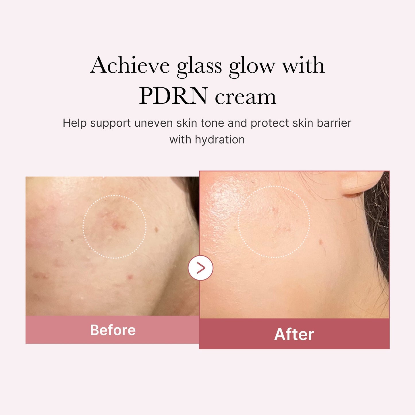 PDRN Pink Repair Cream