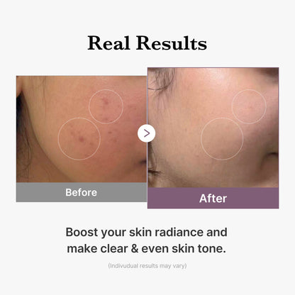 [GIFT] AGE-R Glutathione Glow Milk Toner - medicube.us