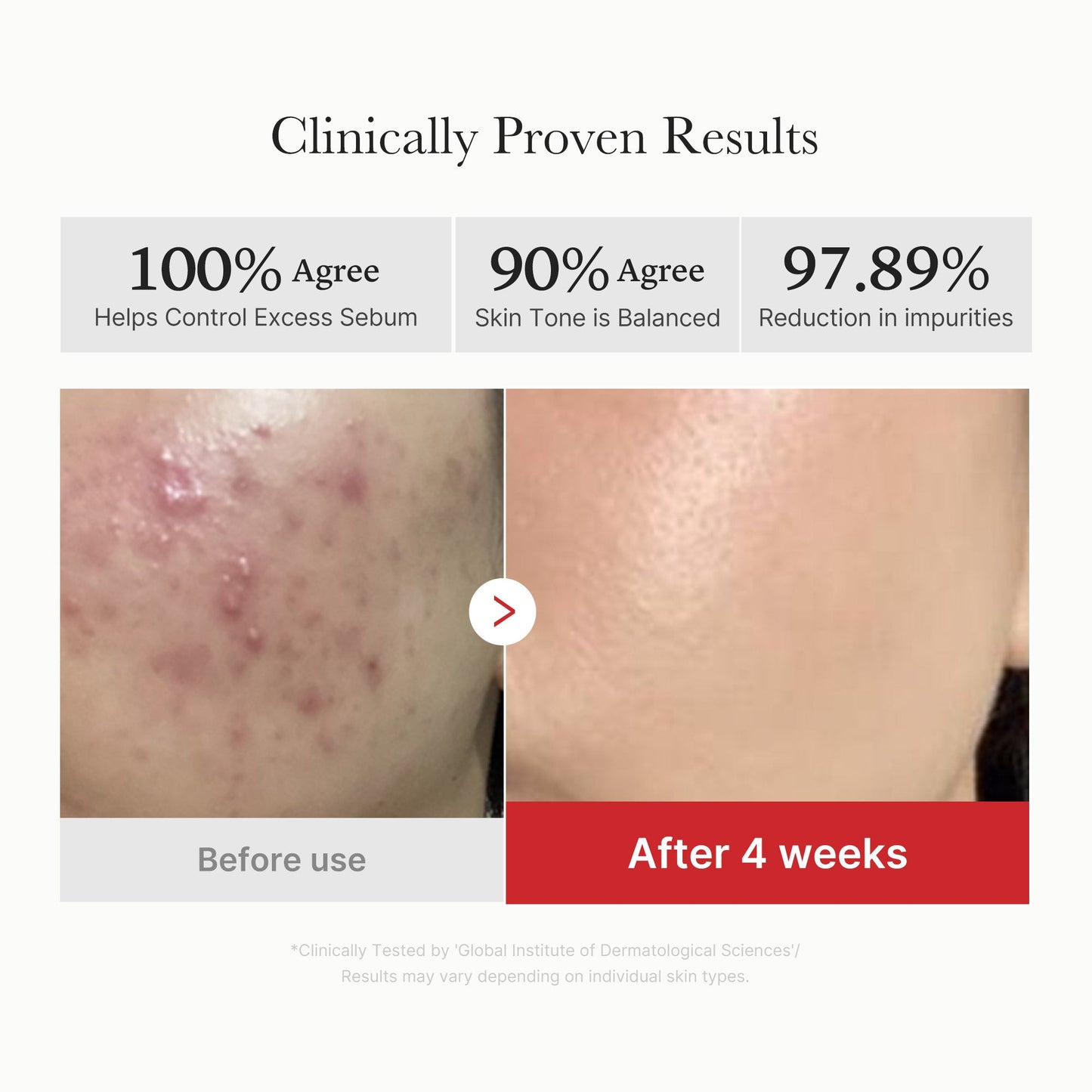 Red Succinic Acid Cream