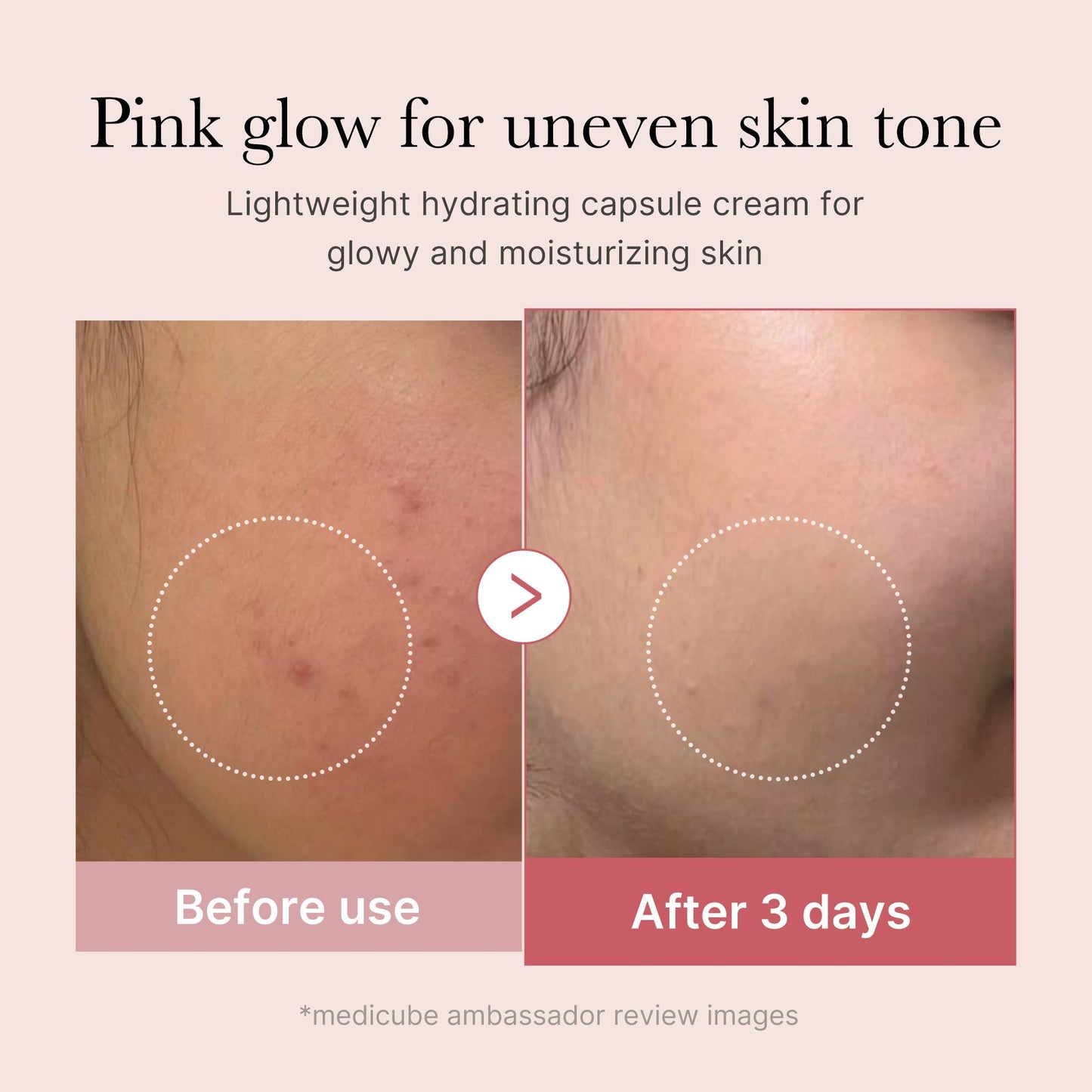PDRN Capsule Cream