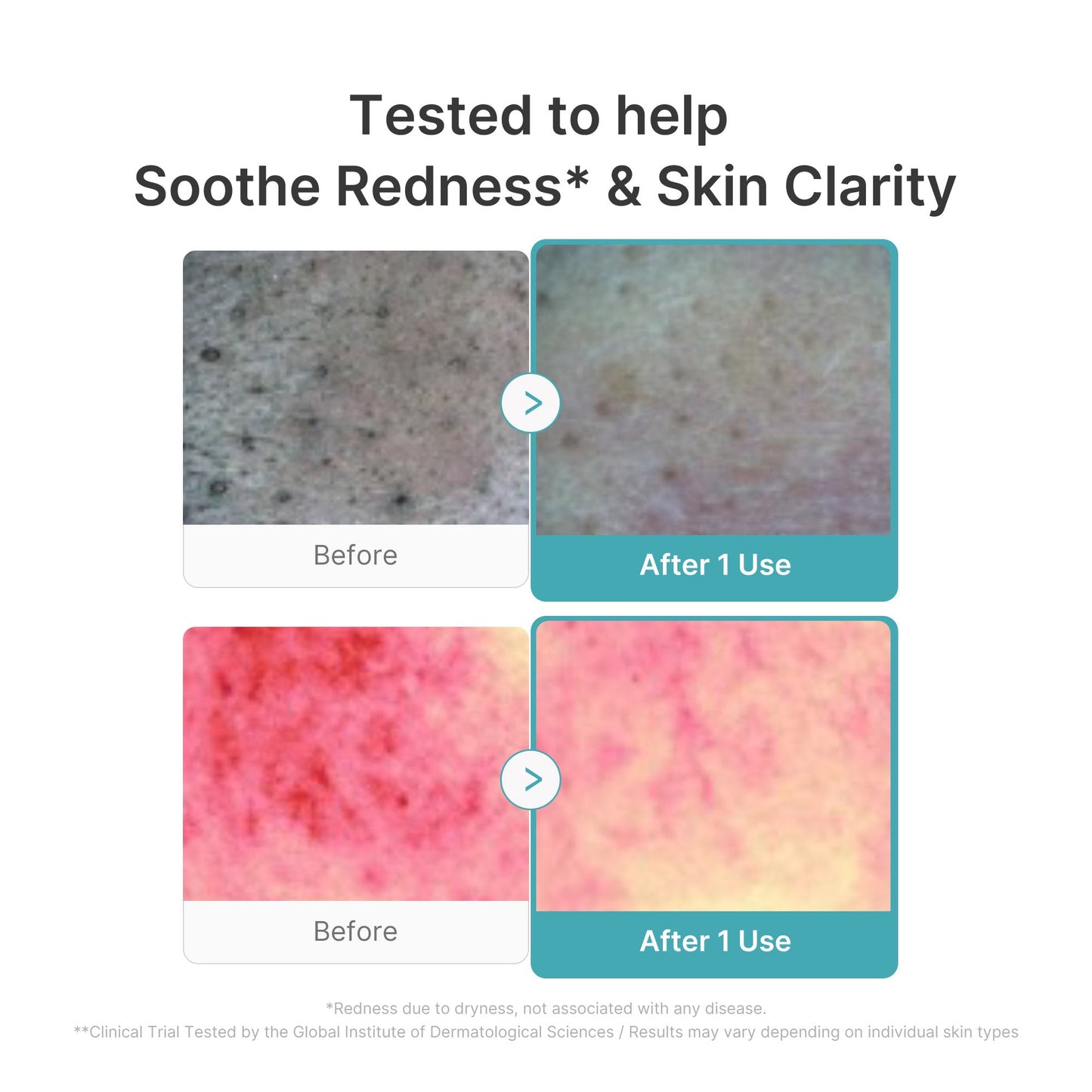 Red Succinic Acid Foam Cleanser