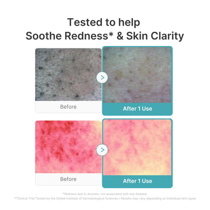 Red Succinic Acid Foam Cleanser