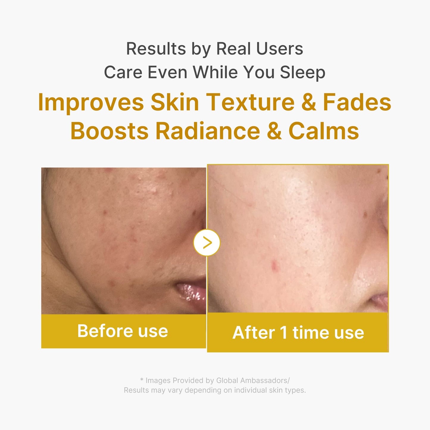 Kojic Acid Turmeric Night Wrapping Mask