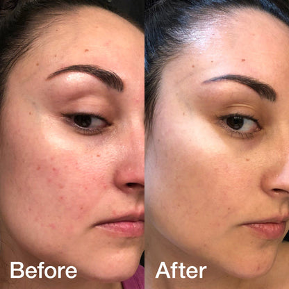 Glass Glow Serum