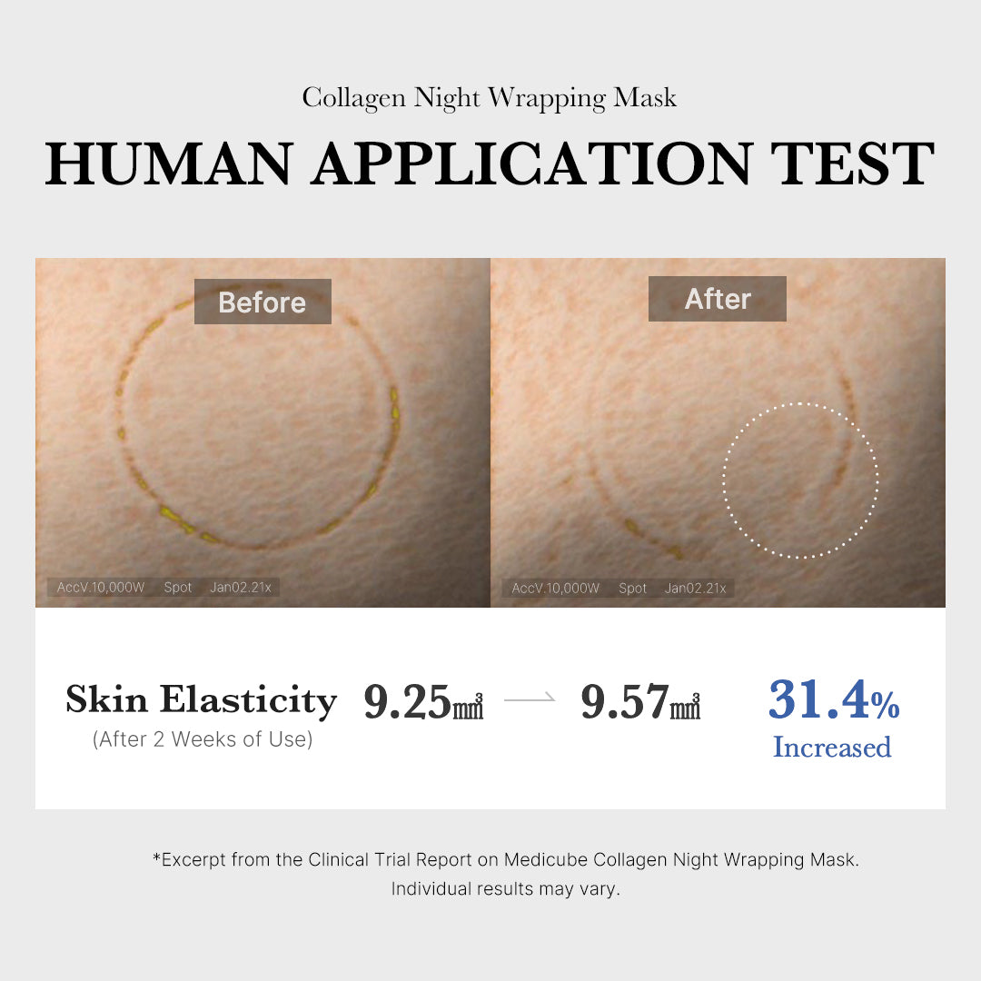 Collagen Lip Treatment
